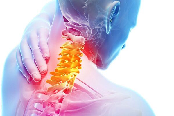 Vzroki za osteohondrozo materničnega vratu