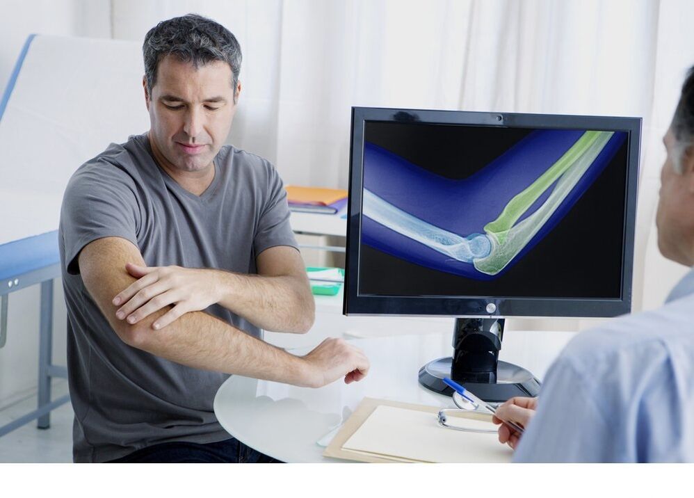 Arthroza komolčnega sklepa na sliki x -ray