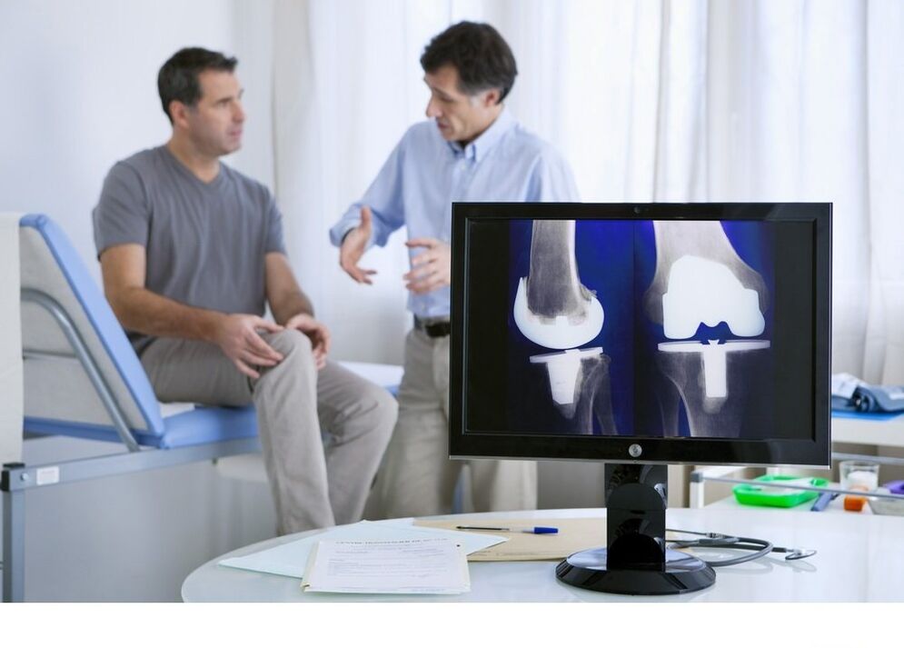 Artroza kolenskega sklepa na sliki x -ray
